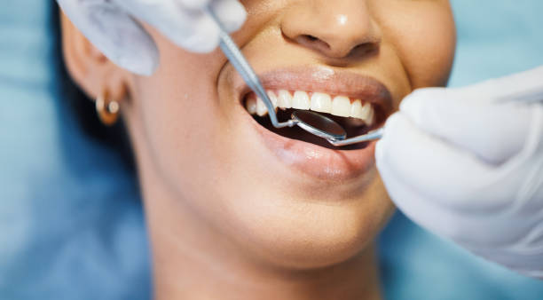 Best Emergency Dental Care for Broken or Chipped Teeth in Mount Joy, PA